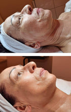 Lade das Bild in den Galerie-Viewer, JetPeel Behandlung Premium (120 Minuten, JetPeel, Serum, 3-D Massage, Agelesspro, Cream Pack und Liftingvlies)