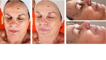Lade das Bild in den Galerie-Viewer, JetPeel Basis (60 Minuten, JetPeel, Serum, Cream Pack &amp; Feuchtigkeitsvlies)
