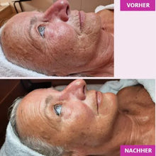 Lade das Bild in den Galerie-Viewer, JetPeel Behandlung Premium  (120 Minuten, JetPeel, Serum, 3-D Massage, Agelesspro, Cream Pack und Liftingvlies)
