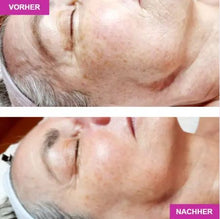Lade das Bild in den Galerie-Viewer, JetPeel Behandlung Premium  (120 Minuten, JetPeel, Serum, 3-D Massage, Agelesspro, Cream Pack und Liftingvlies)
