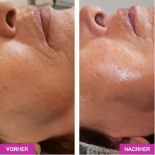Lade das Bild in den Galerie-Viewer, JetPeel Behandlung Premium  (120 Minuten, JetPeel, Serum, 3-D Massage, Agelesspro, Cream Pack und Liftingvlies)
