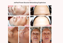 Lade das Bild in den Galerie-Viewer, JetPeel Gesichtsbehandlung Klassik (90 Minuten, JetPeel, Serum, Massage, Cream Pack &amp; Feuchtigkeitsvlies)
