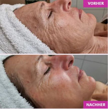 Lade das Bild in den Galerie-Viewer, JetPeel Basis (60 Minuten, JetPeel, Serum, Cream Pack &amp; Feuchtigkeitsvlies)
